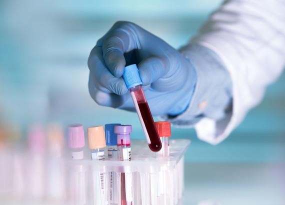Pioneering Advances In Diagnosis Food Allergy Diagnosis Fare Pioneering Advances In Diagnosis Food Allergy Diagnosis Fare
